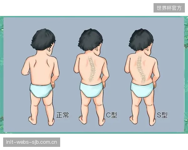 飞跃健身房(广州)部署脊柱侧弯AI监测方案,应对青少年因错误训练姿势引发的体态问题 飞跃健身房(广州)部署脊柱侧弯AI监测方案,应对青少年因错误训练姿势引发的体态问题